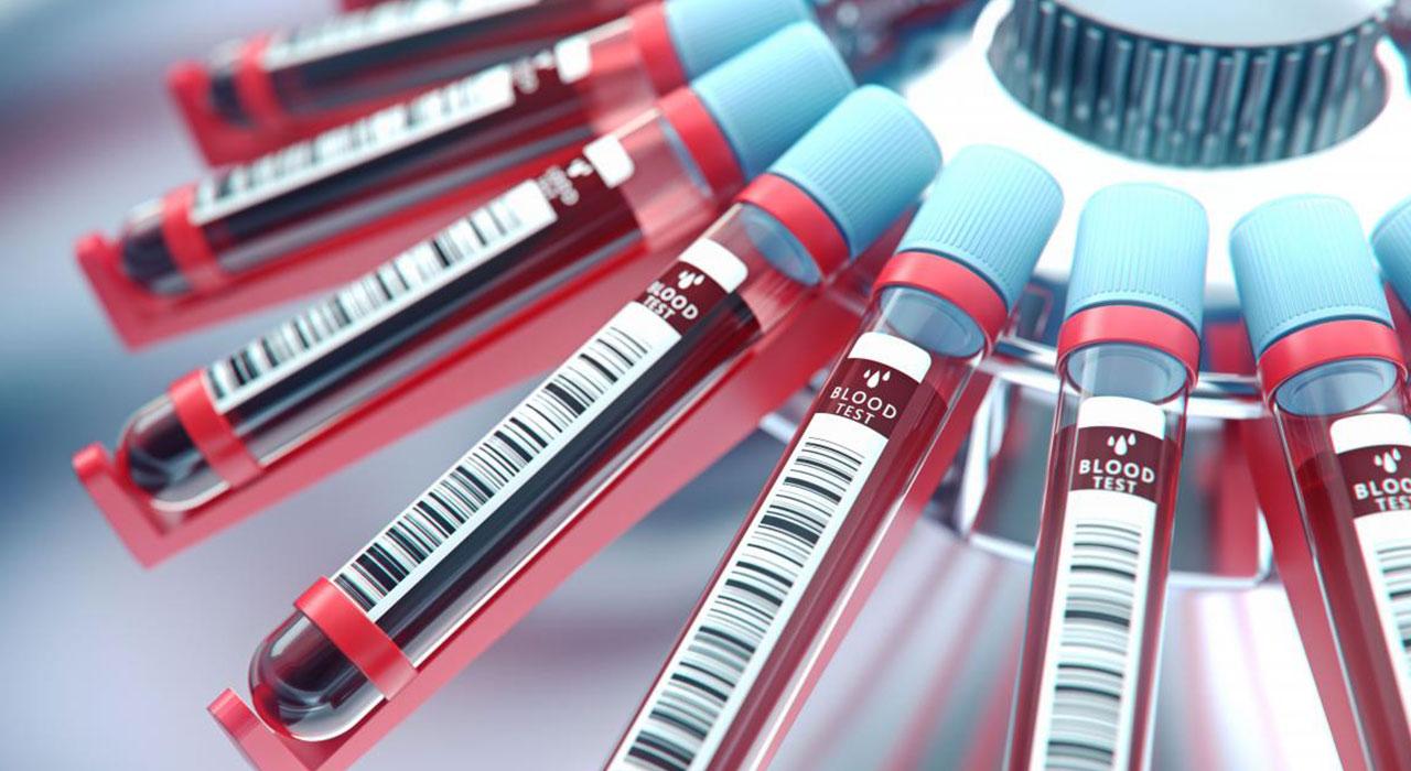 ¿Qué es la hematología?
